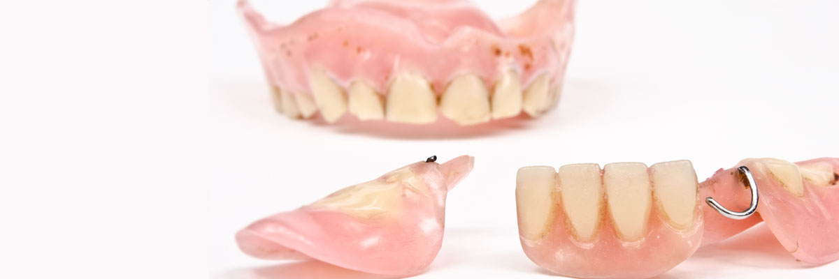 Philadelphia What Do I Do If I Damage My Dentures?