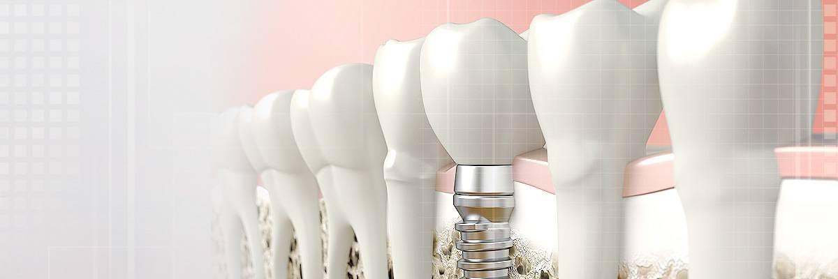 Philadelphia Dental Prosthetics