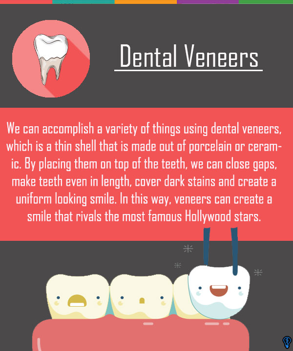 Dental Veneers and Dental Laminates  Philadelphia, PA