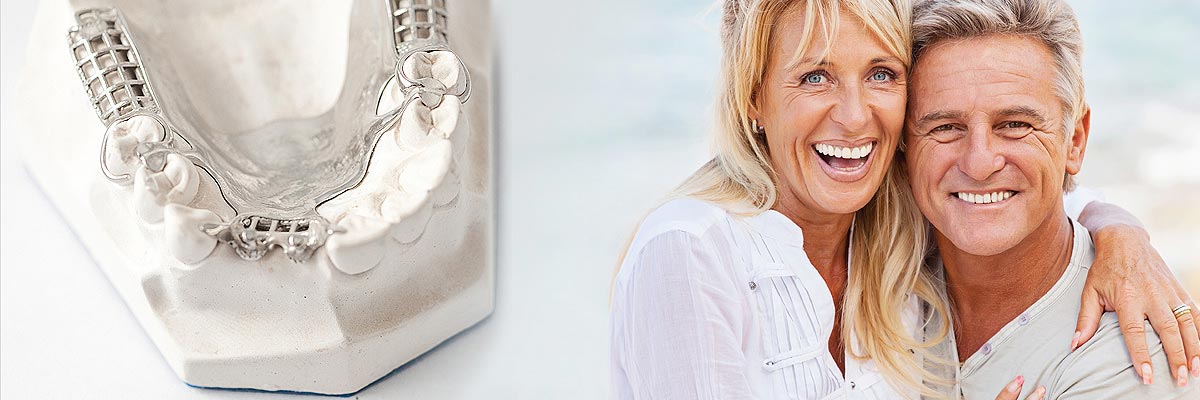 Philadelphia Implant Supported Dentures