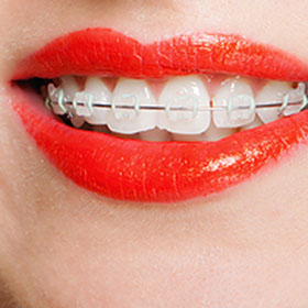 Orthodontics