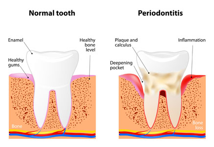 Periodontics