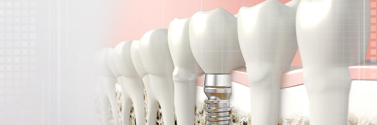 Philadelphia Oral Prosthetics Doctor