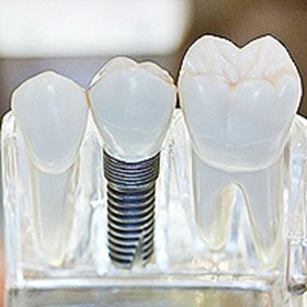 Prosthodontist