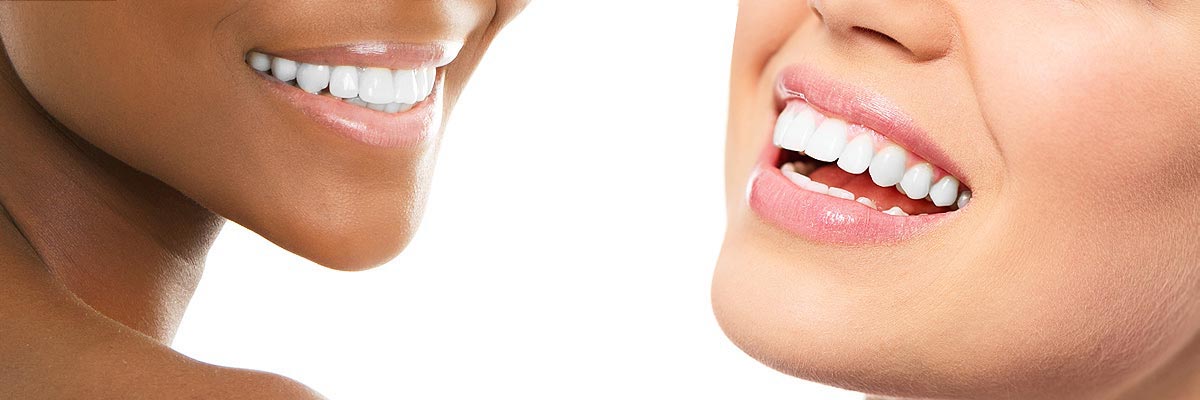  Philadelphia Teeth Whitening