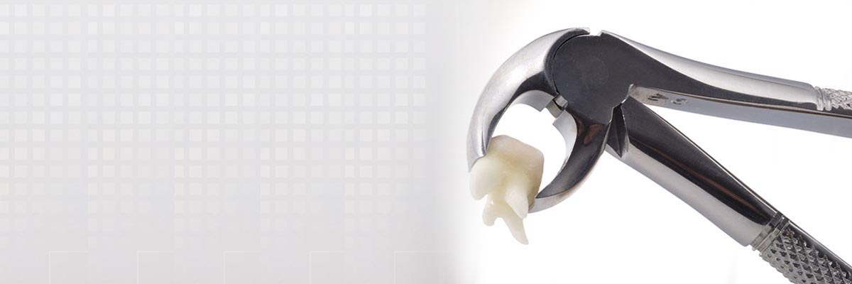 Philadelphia Tooth Extraction